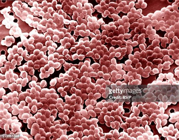 Enterococci Colorized Sem. Enterococci Genus Enterococcus Are Gram Positive Bacteria, Under The Shape Of Cocci Or Cocobacilli, Facultative Anaerobes....