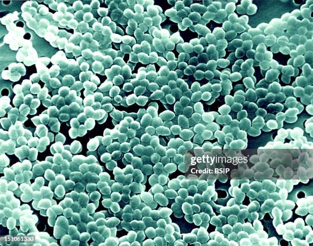 Enterococci Colorized Sem. Enterococci Genus Enterococcus Are Gram Positive Bacteria, Under The Shape Of Cocci Or Cocobacilli, Facultative Anaerobes....