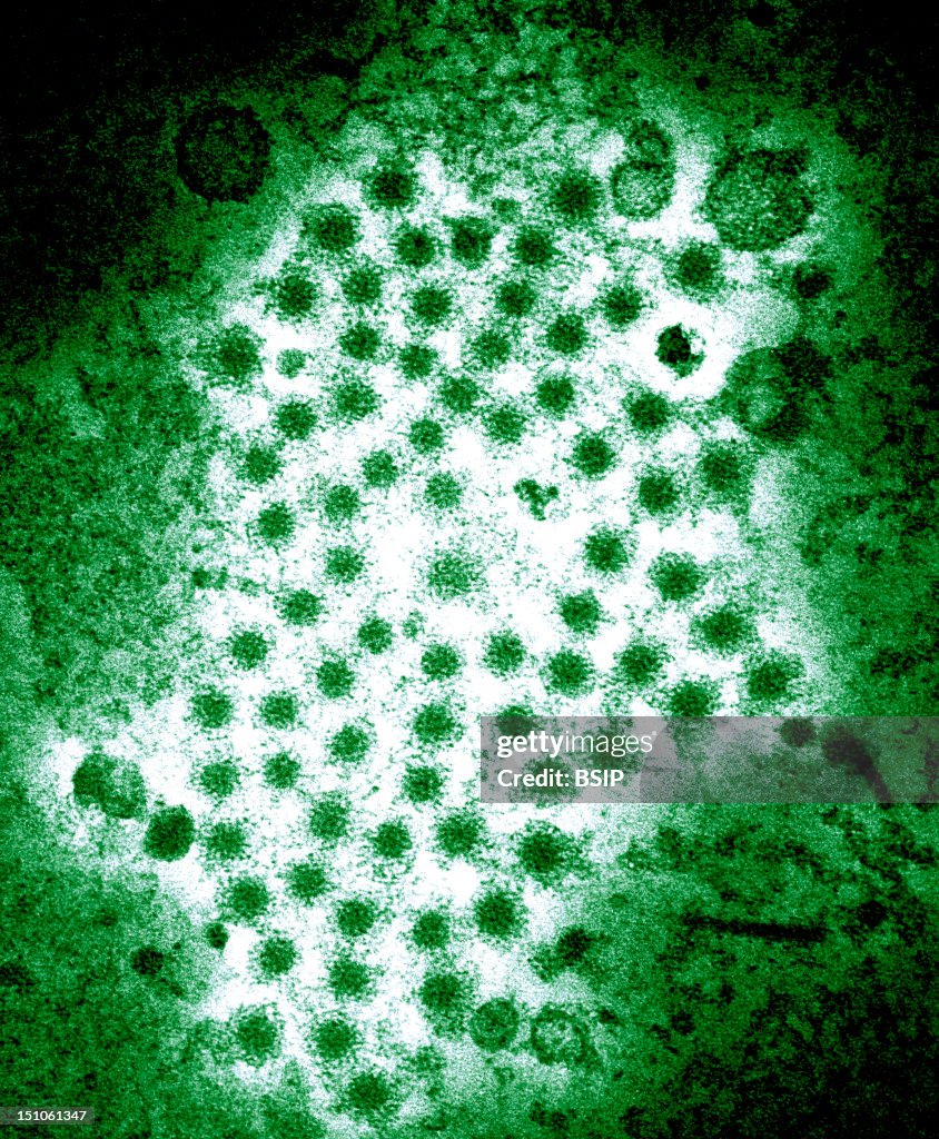 Hepatitis Virus, Tem