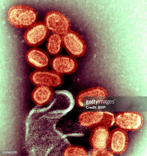 Virus H1N1, Responsible For The Deadly Pandemy Of Spanish Flu In 1918 Tem. In 2005, Dr Terrence Tumpey National Center For Infectious Diseases, Cdc...