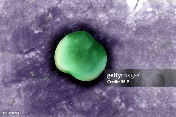 Gonococcus Bacterium. Sem X 30 000