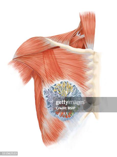 The Tissues Of The Breast Conjunctive And Glandular Tissues Acini And Galactophorous Canals. Position Of Conjunctive Tissue Surrounding The Acini And...