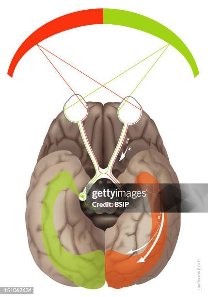 Route Of The Visual Information In The Brain. Departure Of The Information Vision Field. Receptor Eye Via The Ganglion Cells Of The Retina ; X Cells...