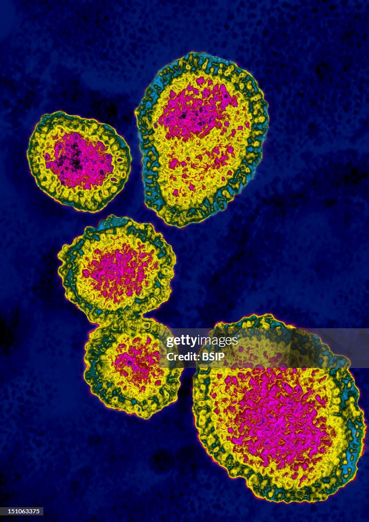 Influenza A H1N1 Virus