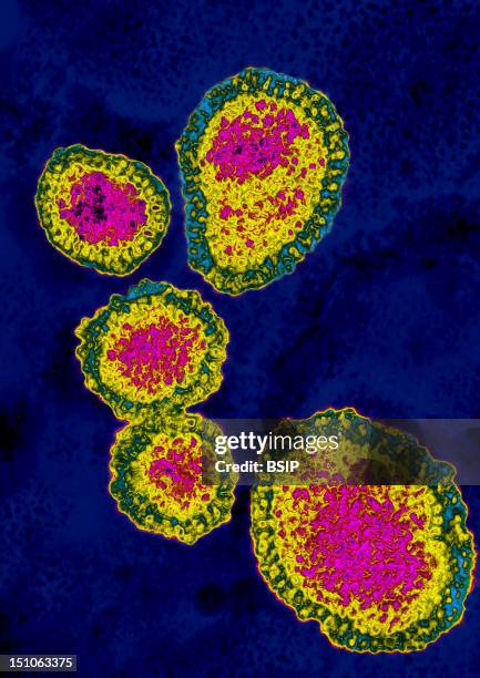 Myxovirus Influenza A H1N1. Swine Influenza Visualized By Hdri Image Treatment, On A View Under Transmission Electron Microscope. Viral Diameter Of...