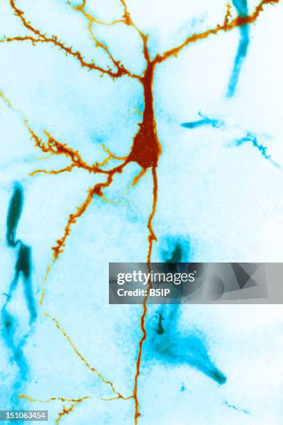 Pyamidal Neuron Of The Mouse Brain Red Is Composed Of A Cell Body, An Axon The Long Prolongation With A Regular Contour And Several Dendrites. The...