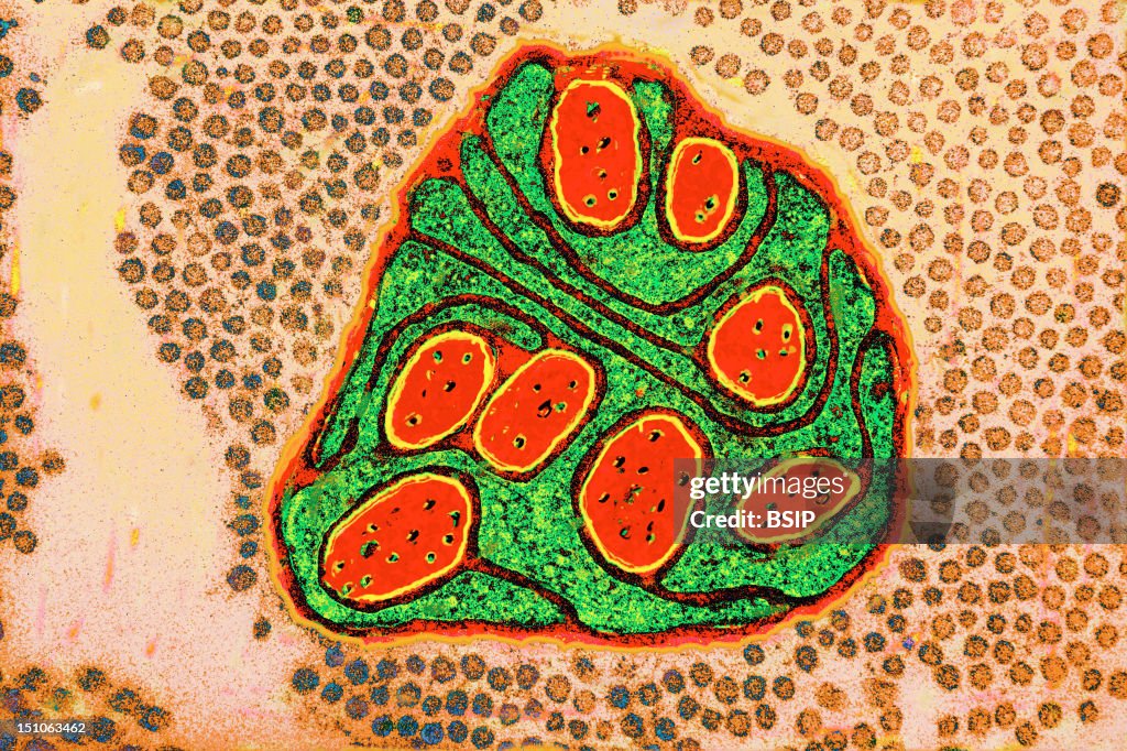 Nerve Fibers, Tem