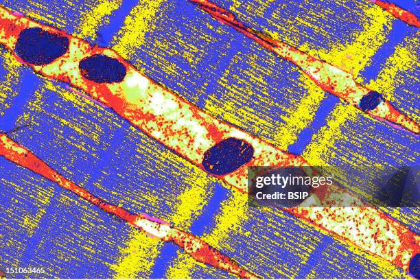 Partially Contracted Striated Muscle Fiber. This Type Of Fiber Is Composed Of Two Myofilaments. The Yellow Bands Are Anchored On The Dark Blue...