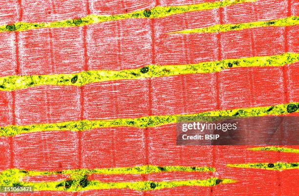 Contracted Striated Muscle Fiber. This Type Of Muscle Fiber Is Composed Of Two Bands Which Glide Over Each Other When The Muscle Contracts. This...