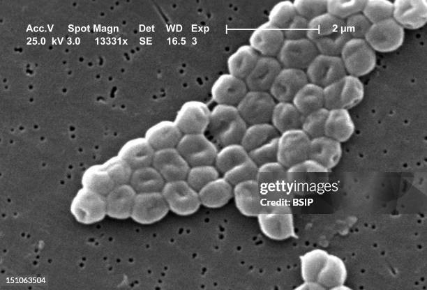 This Sem Depicts A Highly Magnified Cluster Of Gram Negative, Non Motile Acinetobacter Baumannii Bacteria; Mag: 13331X. Members Of The Genus...