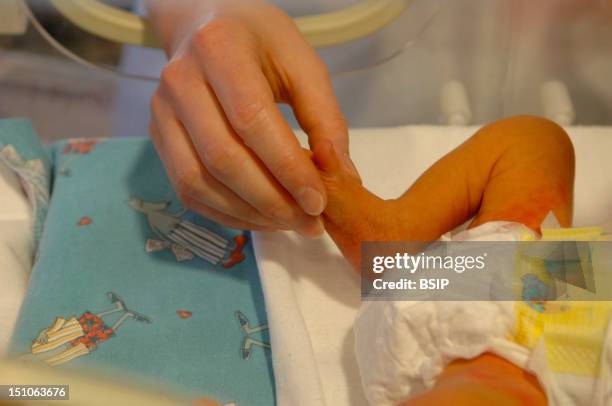 Photo Essay From Hospital. Civil Almhouse Of Lyon, Maternity Of Croix Rousse Hospital, Unit Of Neonatology, France. Examination Of The Reflexes Of A...