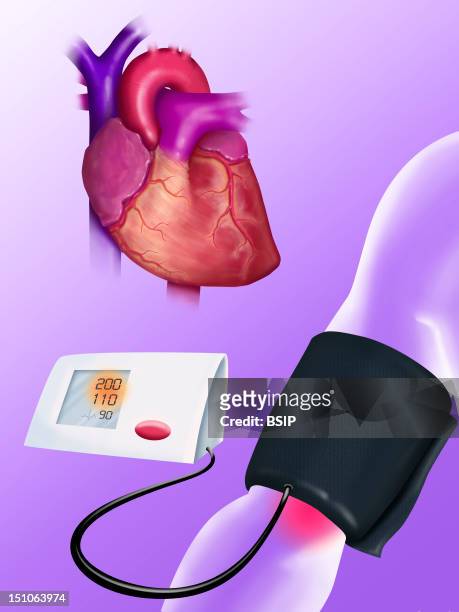 Symbolic Illustration Of Blood Pressure Taking With A Digital Sphygmomanometer. Here, High Blood Pressure. See Image 0324407 For A Mechanical...