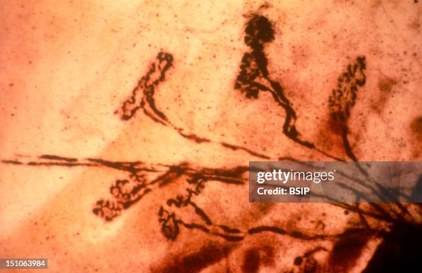 Motor End Plate Or Neuromuscular Synapse Junction Between The Efferent Neuron And The Muscle Fiber. Optic Microscopy About X 150 The Size Of An Image...