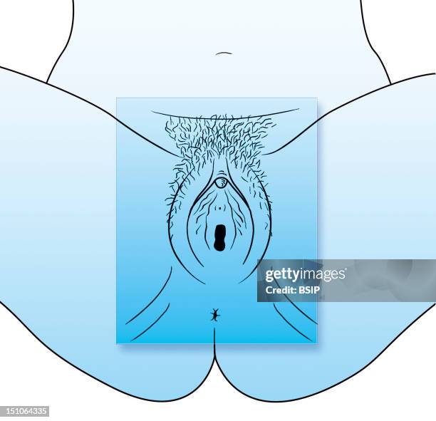 Female External Genital Organs Gynecological View. See Images 0348407 And 0348507 For The Male External Genital Organs, 0348707 For The Female...