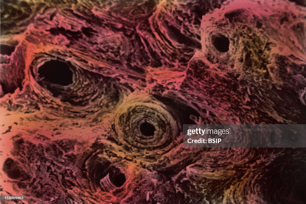 Compact Bone, Sem