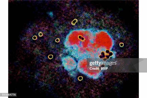 Black And Yellow Spots Are Cultures Of Staphylocoque Aureus.