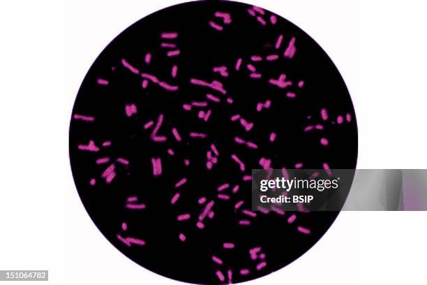 Lab Coli Scope 294 E Coli Microscope Stock Photos, High-Res Pictures, and Images ...
