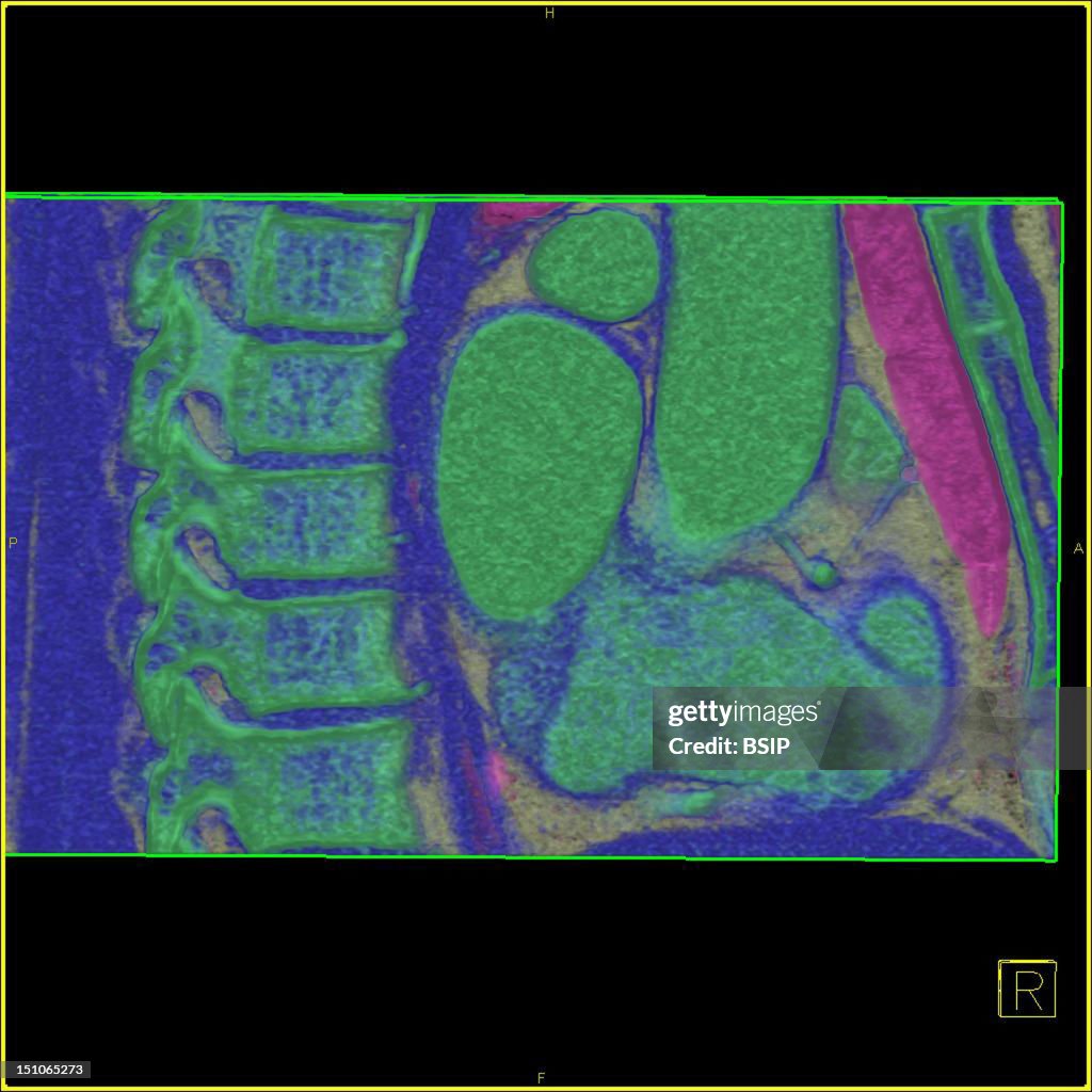 Thorax, Scan