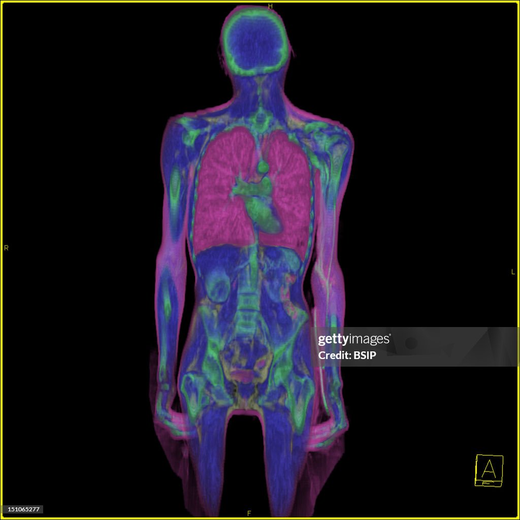 Anatomy