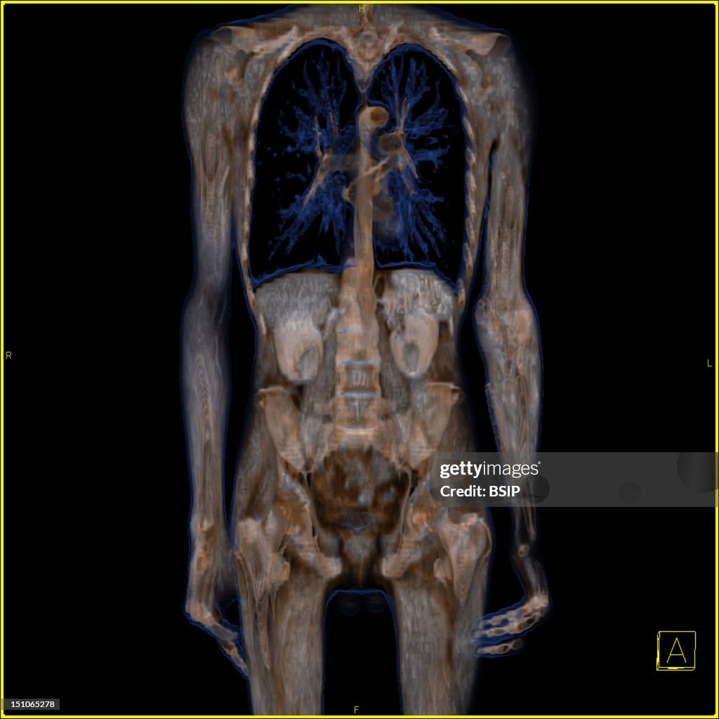 Anatomy