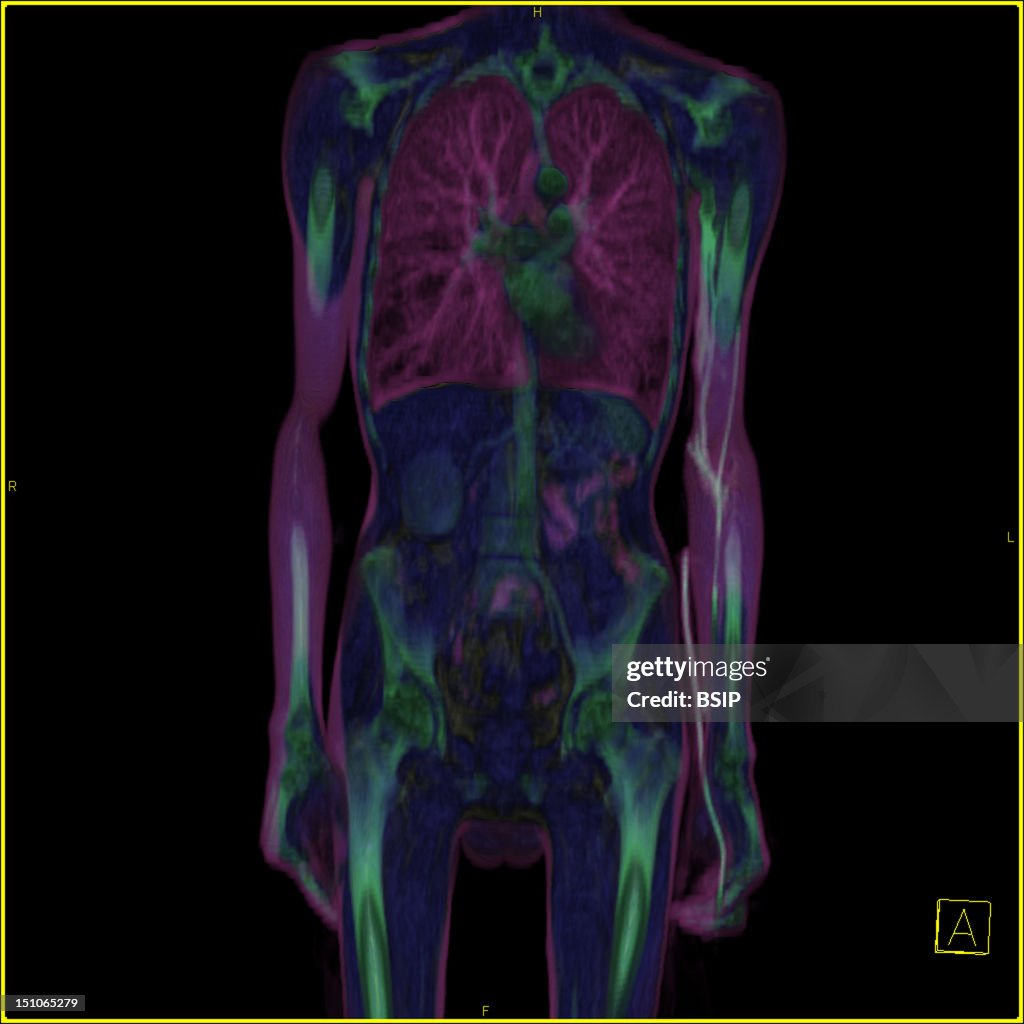 Ct Scanner Front View Rendered Entire Body, Frontal View. 3D Ct Scan. The Icon At The Bottom Right ...