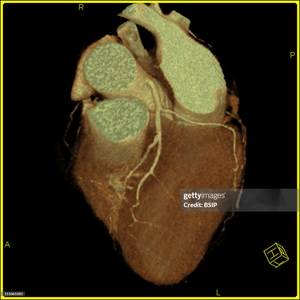 Heart, Scan