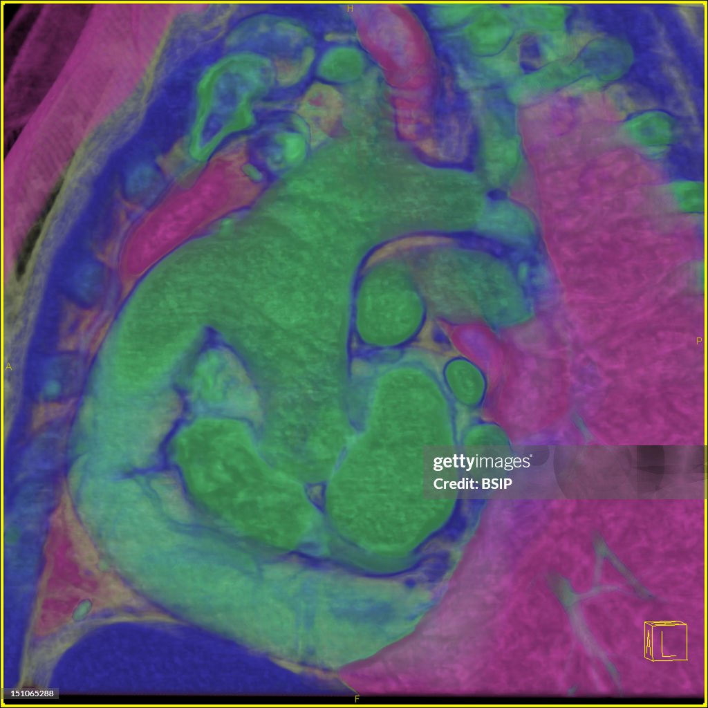 Thorax, Scan