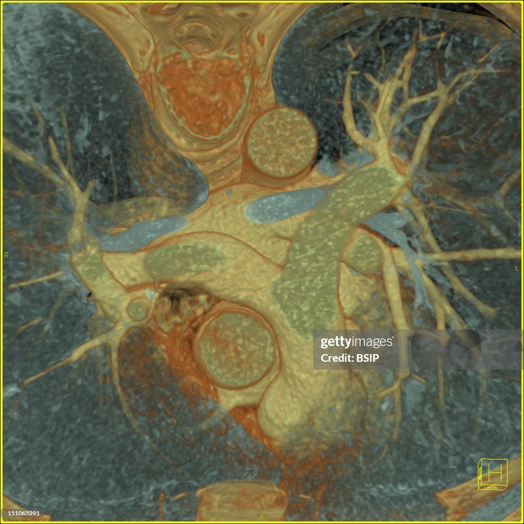 Respiratory Tract, Scan