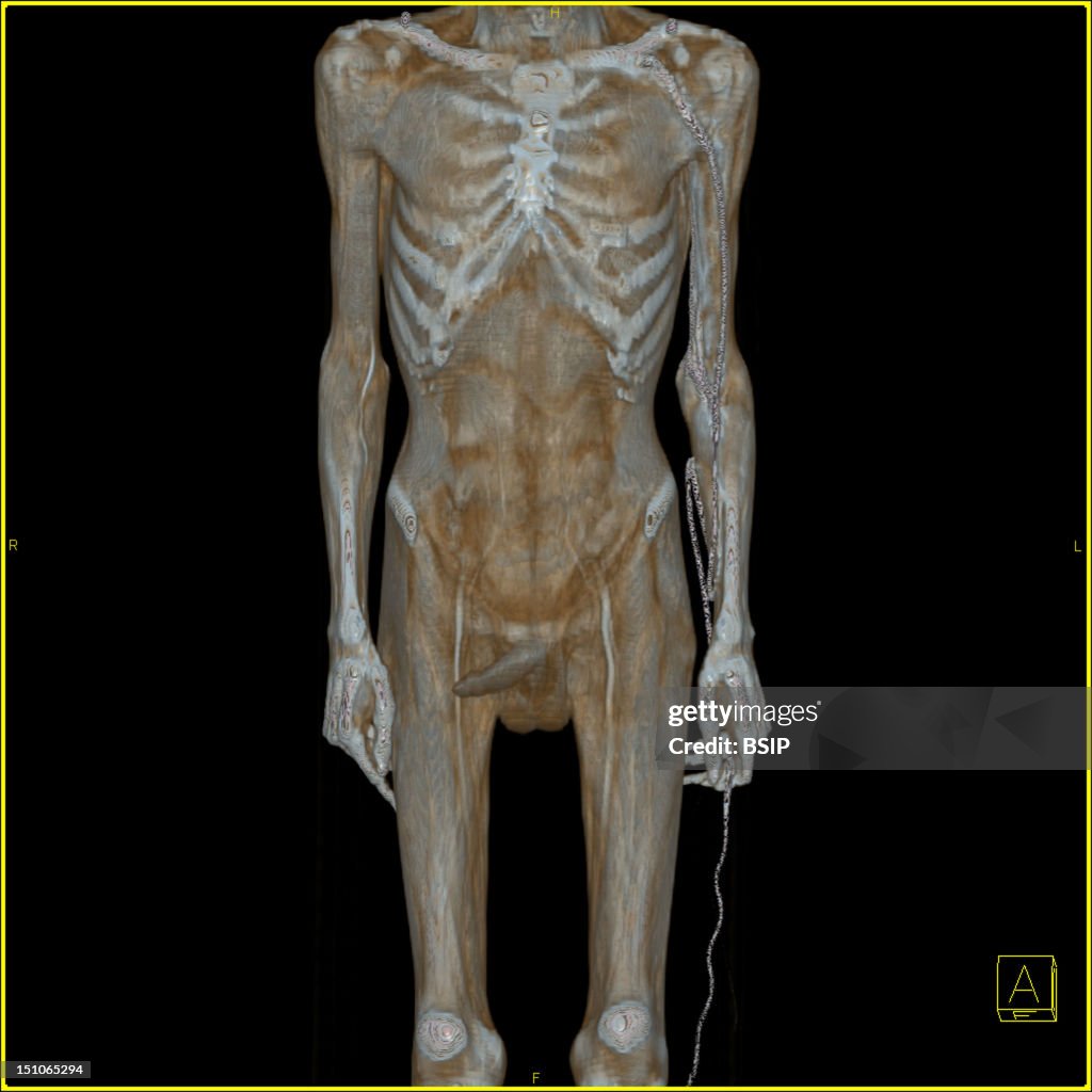 Anatomy