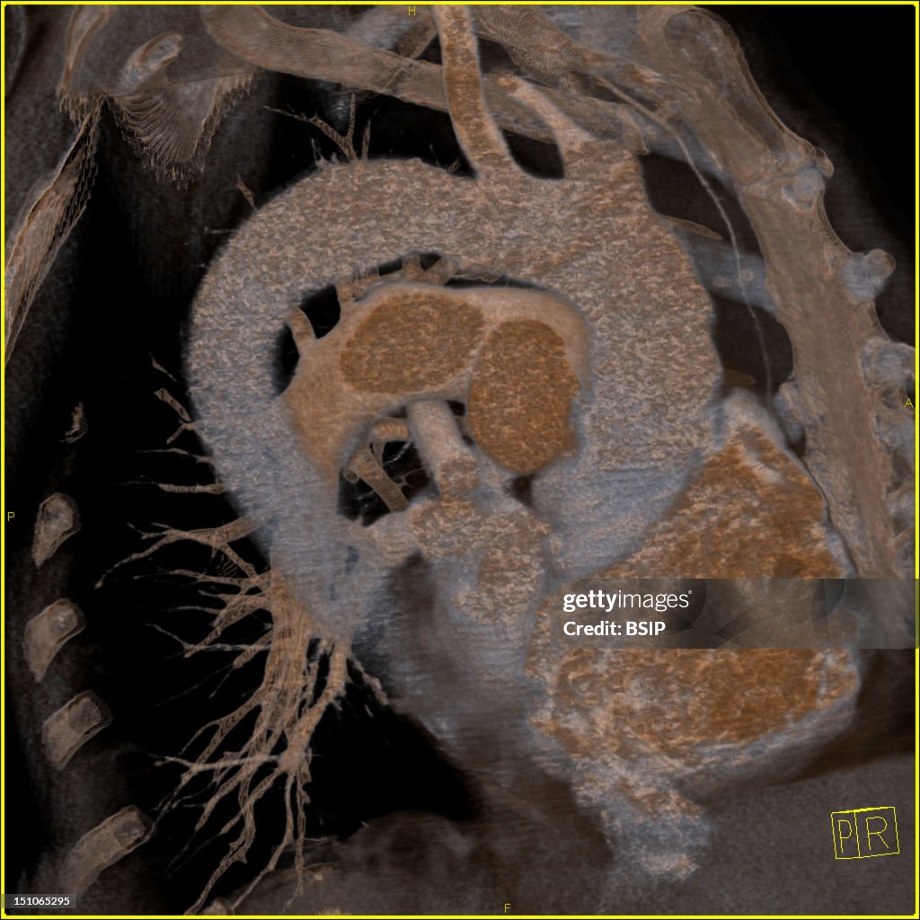 Thorax, Scan