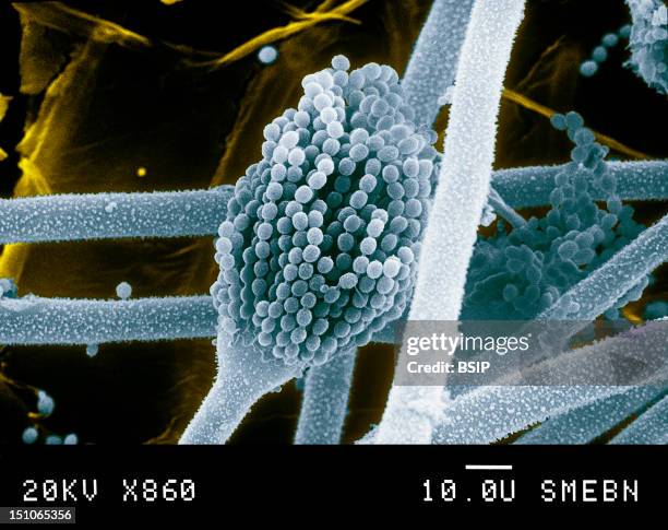 Aspergillus Is A Microscopic Fungi Belong To The Actinomycetes Family. Aspergillus Flavus Is A Pathogenic Germ Causing A Disease Called...