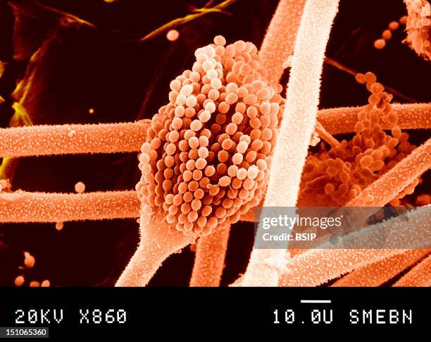 Aspergillus Is A Microscopic Fungi Belong To The Actinomycetes Family. Aspergillus Flavus Is A Pathogenic Germ Causing A Disease Called...