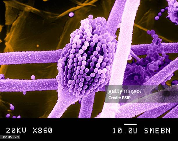 Aspergillus Is A Microscopic Fungi Belong To The Actinomycetes Family. Aspergillus Flavus Is A Pathogenic Germ Causing A Disease Called...