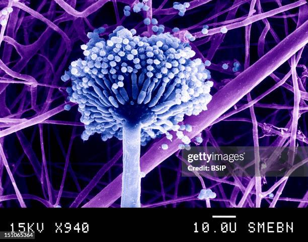 Mold Shape Microscope 263 Mold Microscope Stock Photos, High-Res Pictures, and Images - Getty ...