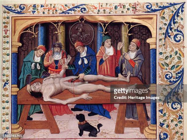 Autopsy. From Livre des propriétés des choses by Barthélemy l'Anglais, 15th century. Found in the collection of the Bibliothèque Nationale de France....