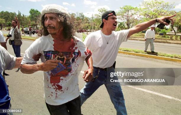 Demonstrators helps another demonstrator who was hurt by police's rubber bullet 15 March 2000 after a confrontation with police anti-riot in front of...