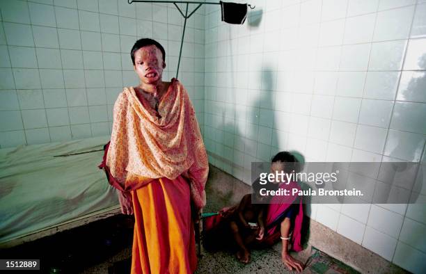 Popi, a 22 year old Bangladeshi woman, sits on the edge of her bed in Dhaka's only hospital burn unit at Dhaka Medical College in Dhaka, Bangladesh...
