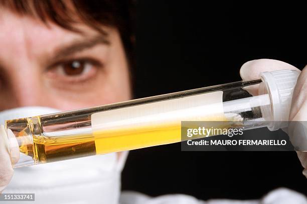 urine samples - blood urine stock pictures, royalty-free photos & images