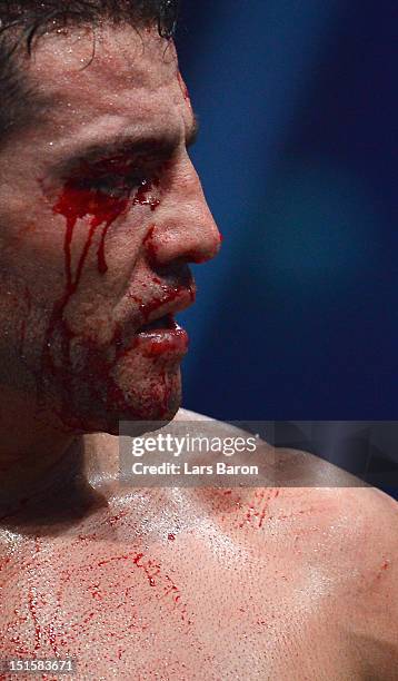 Manuel Charr of Germany reacts after referee Guido Cavalleri of Italy finished the WBC-heavy weight title fight between Vitali Klitschko of Ukraine...