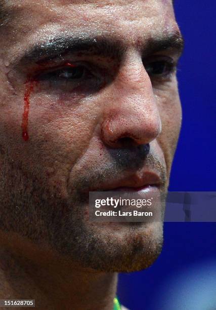 Manuel Charr of Germany is seen after loosing the WBC-heavy weight title fight between Vitali Klitschko of Ukraine and Manuel Charr of Germany at...