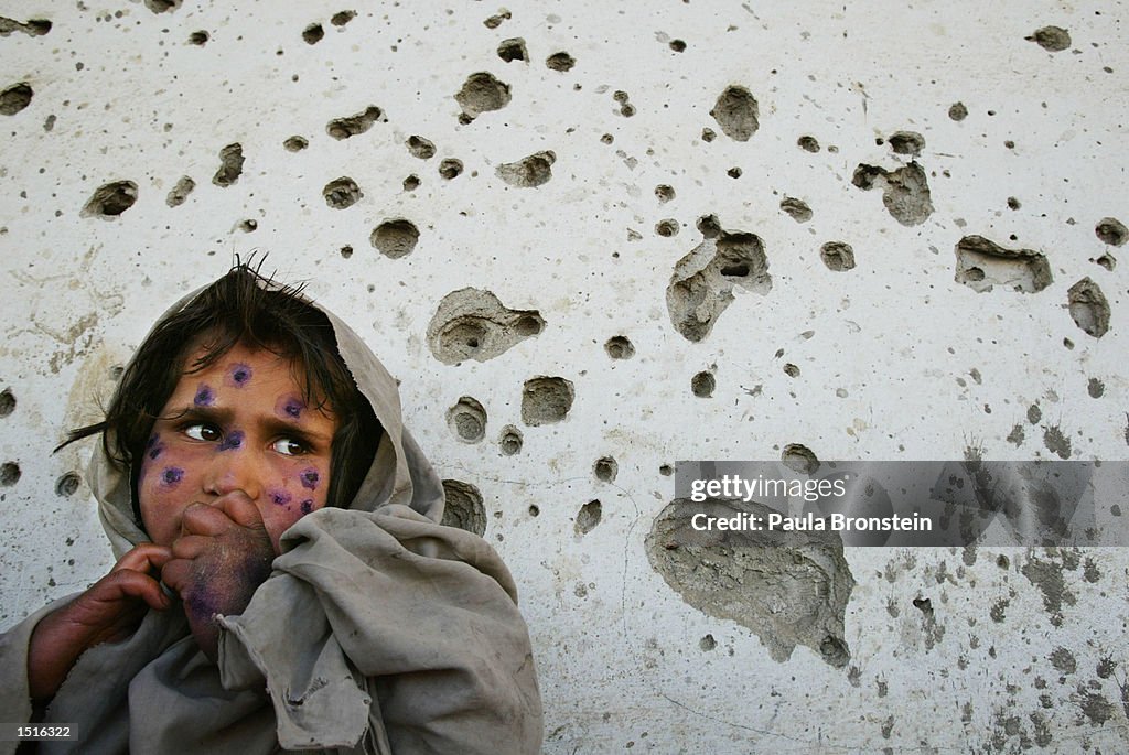 Lashmania Treatment In Kabul