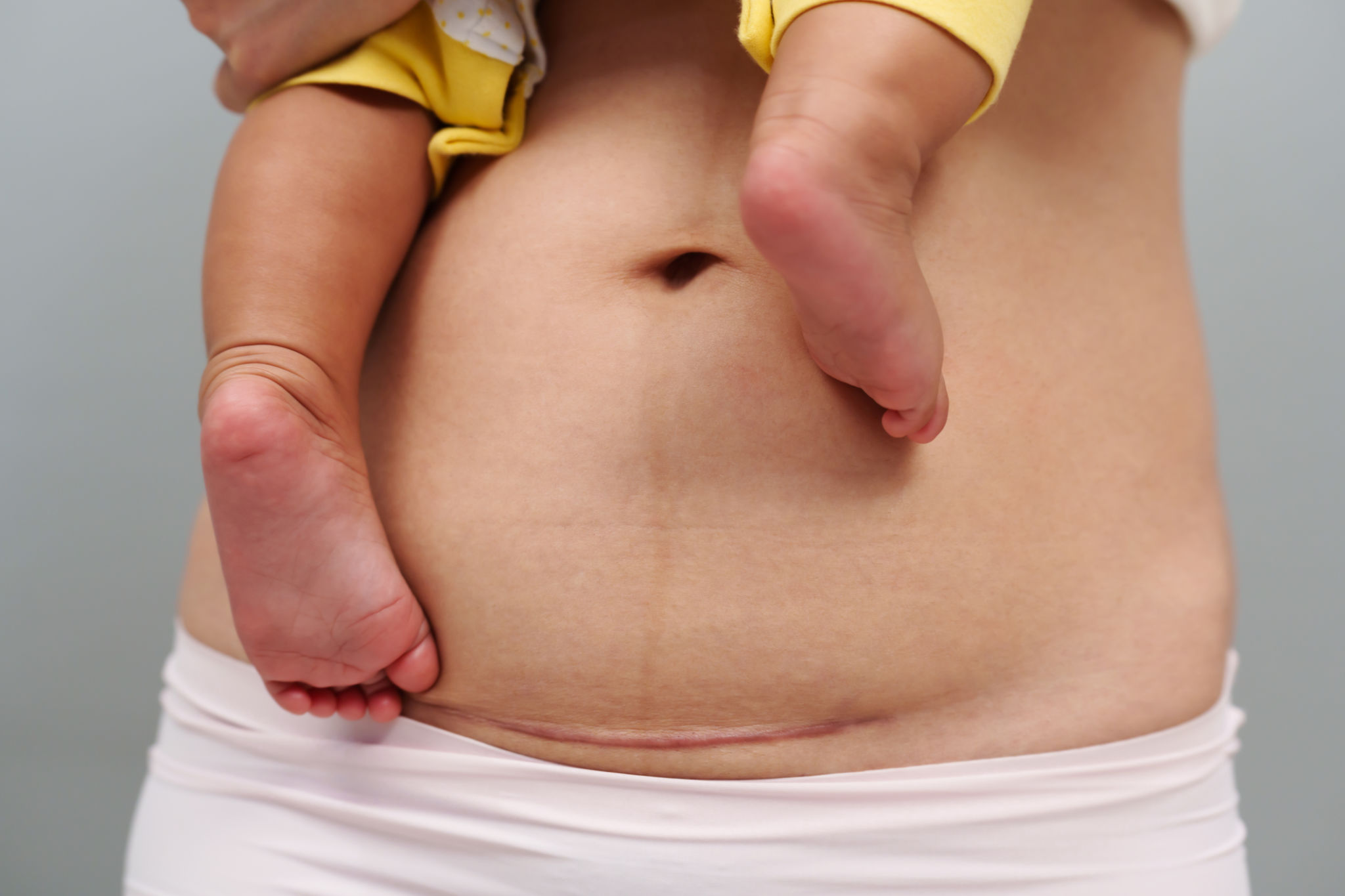 postpartum care