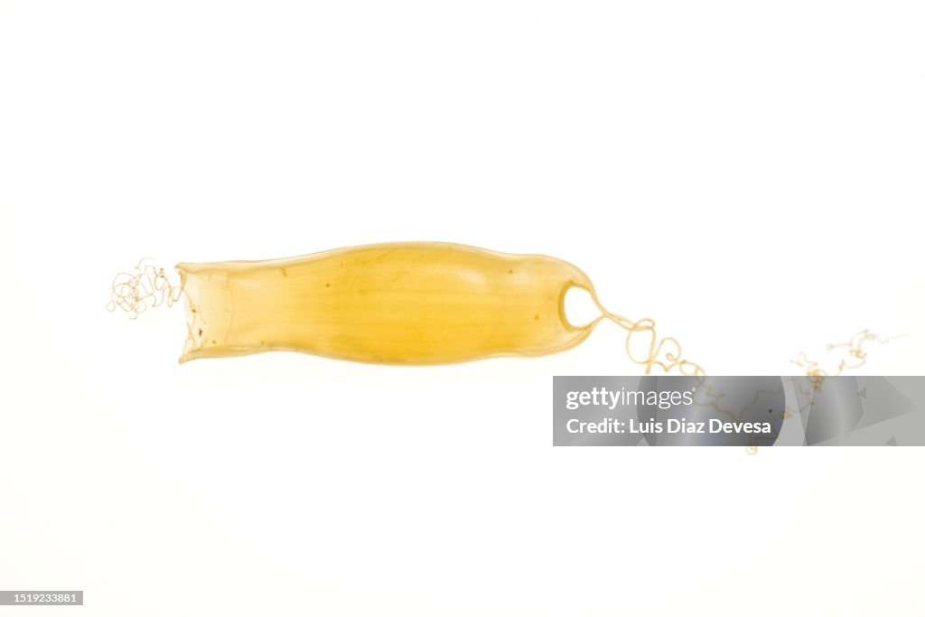 Yellow mermaid's purse