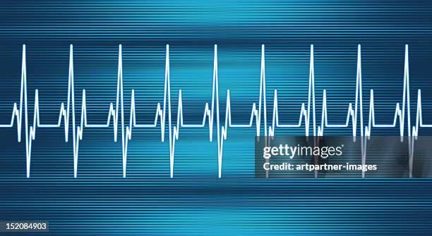 heart rate line - 心臓刺激伝導系 ストックフォトと画像