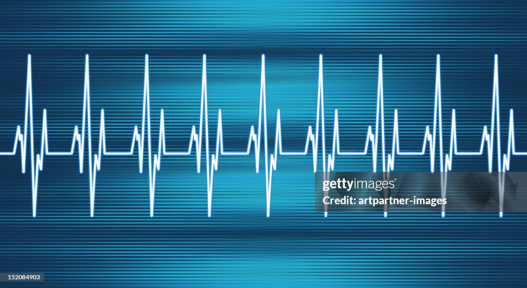 Heart Rate Line