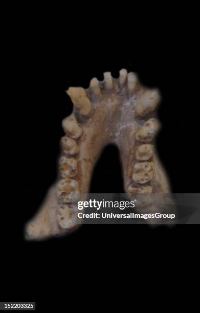 Part of lower jaw of Dryopithecus fontani, an extinct ape that was first discovered in Saint-Gaudens, Garonne, France. This example is approximately...