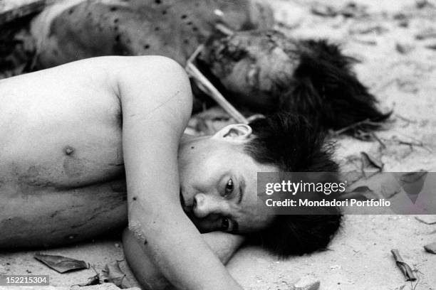 Young Viet Cong, injured and captured, pulled out from a crater after a mine explosion; beside him, a companion lies dead. Vietnam, 1968.