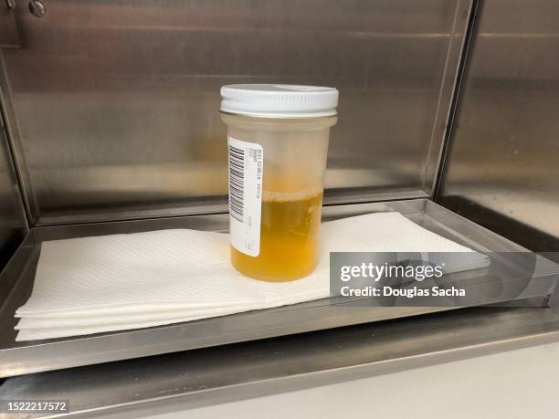 urine sample in a clinical specimen container - urine sample stock-fotos und bilder