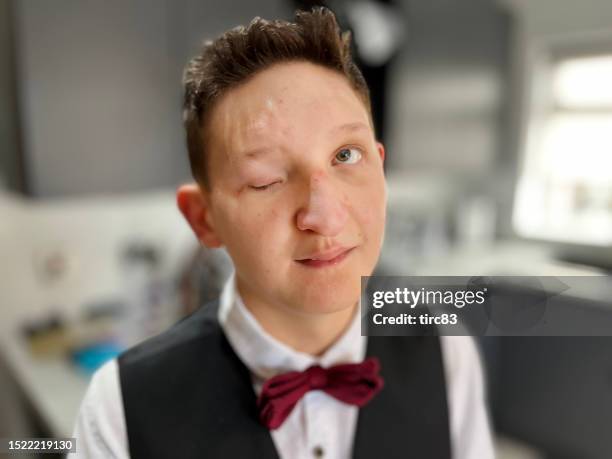 teenage boy with partial blindness dressed for prom - blind man stock pictures, royalty-free photos & images