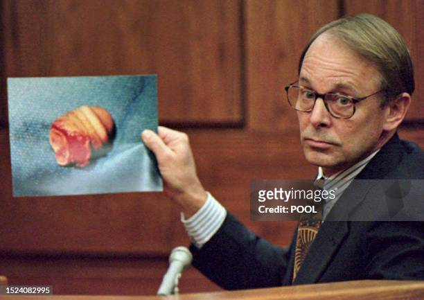 Dr. James T. Sehn holds a photo of the severed penis of John Wayne Bobbitt during the second day of the malicious wounding trial of Lorena Bobbitt in...